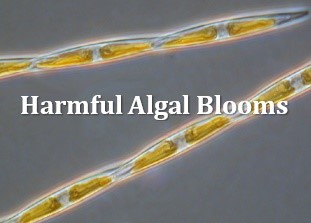 Pseudo-nitszchia cells, which produce the toxin domoic acid